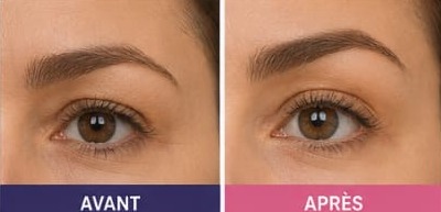 Lift des sourcils