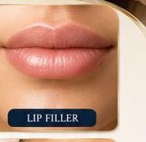 Lip Filler
