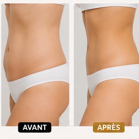 Lipo Cavitation